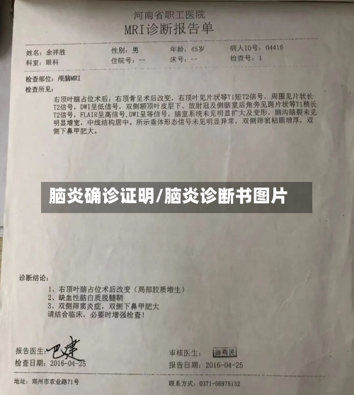 脑炎确诊证明/脑炎诊断书图片-第2张图片