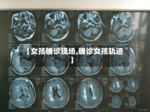 【女孩确诊现场,确诊女孩轨迹】-第3张图片