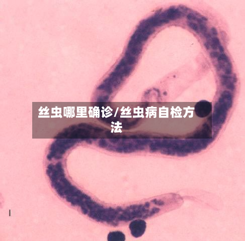 丝虫哪里确诊/丝虫病自检方法-第2张图片