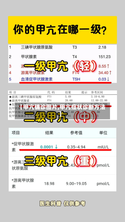 【甲亢确诊图片,甲亢症状诊断方法】