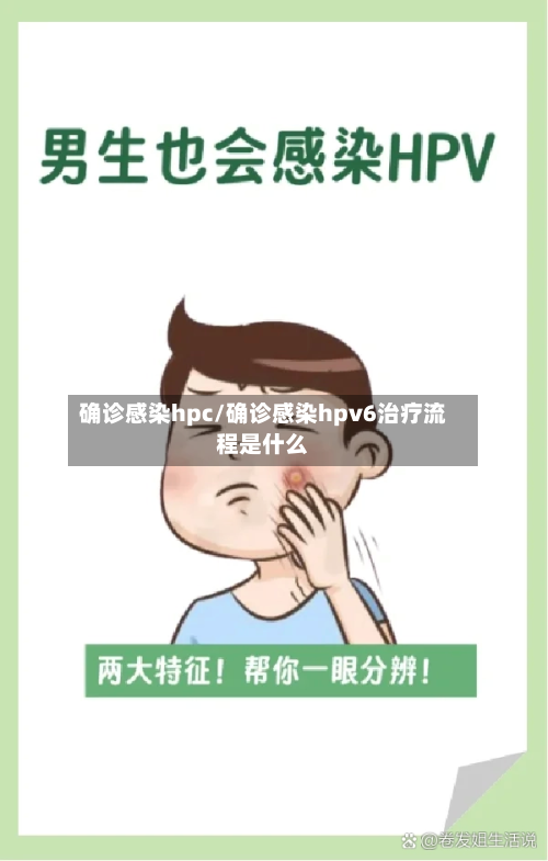 确诊感染hpc/确诊感染hpv6治疗流程是什么