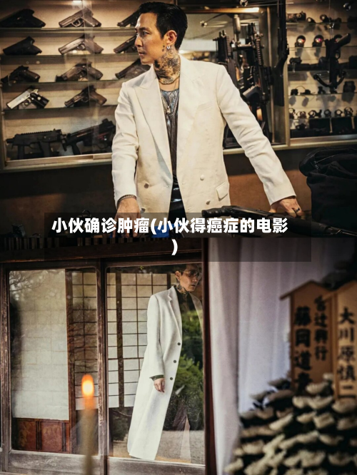 小伙确诊肿瘤(小伙得癌症的电影)-第2张图片